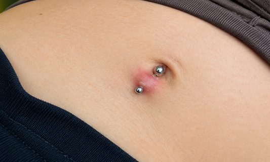 navel. piercing infected