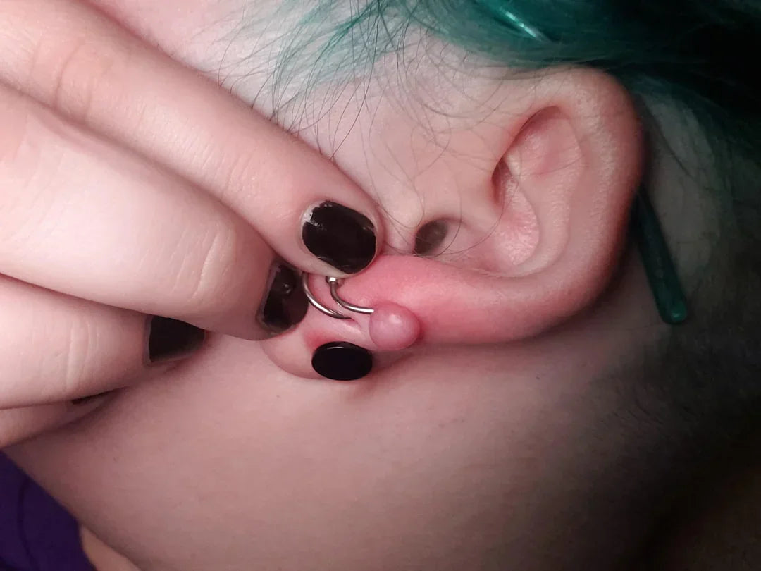 Piercing Bumps Explained: Causes, Treatment, and How to Make Them Go Away