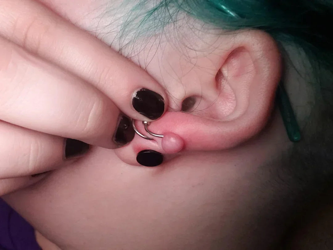 Piercing Bumps Explained: Causes, Treatment, and How to Make Them Go Away