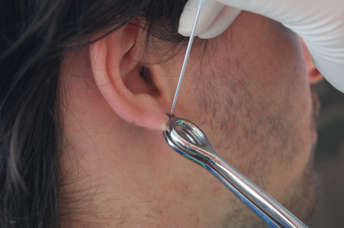 Why Is It Better to Use a Needle for Ear Piercing?
