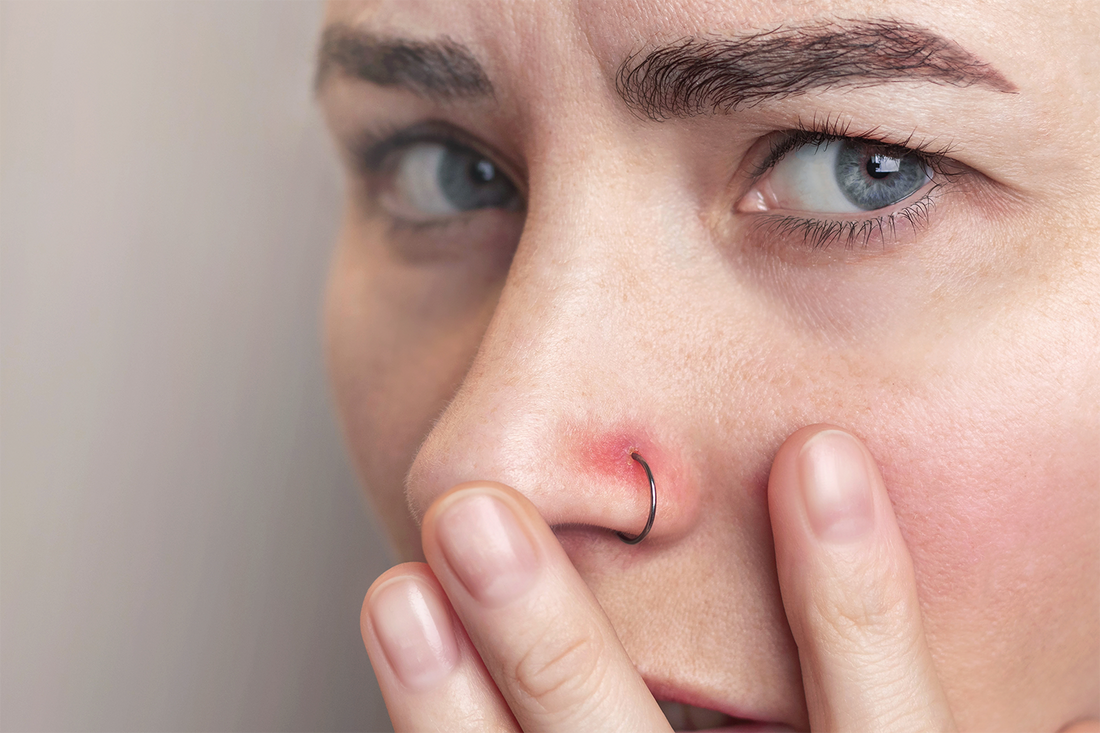 How To Treat an Infected Nose Piercing Safely: Symptoms, Causes and Treatment