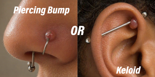 piercing bump vs keloid photo